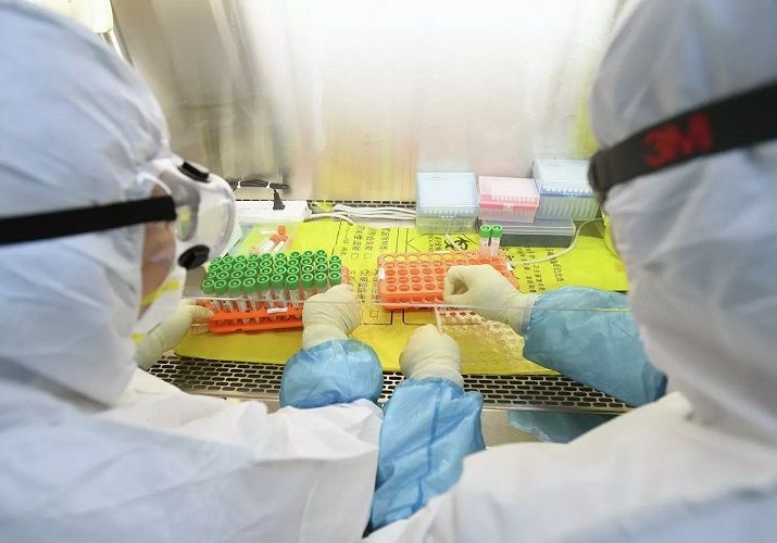 İtaliyada koronavirusa yoluxanların sayı 79 nəfərə çatıb