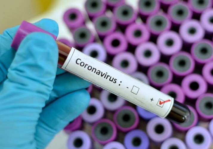 Azərbaycanda koronavirusa yoluxanların sayı 641-ə çatıb, 44 nəfər sağalıb, 7 nəfər ölüb