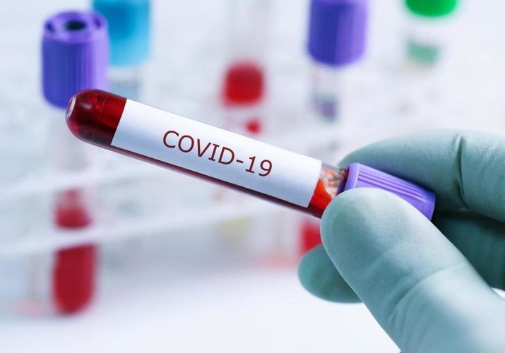 Koronaviruslu xəstələrdən 37-nin vəziyyəti ağırdır, onlardan 20-dən çoxu “Yeni klinika”da müalicə alır