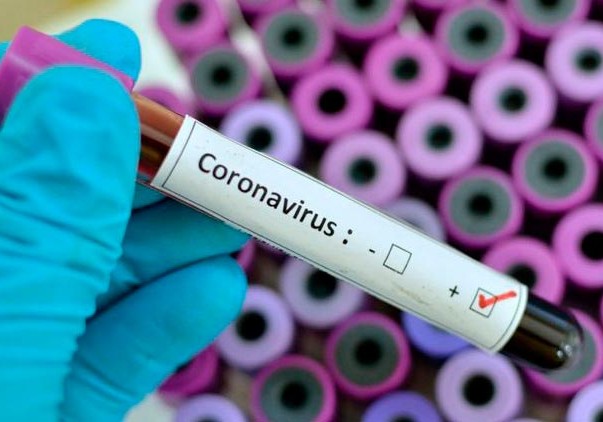 Dünyada koronavirusdan ölənlərin sayı 190 mini keçib