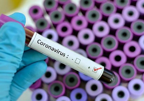 Gürcüstanda daha 29 nəfər koronavirusa yoluxub, 1 nəfər ölüb