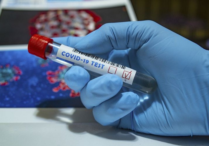 Azərbaycanda daha 106 nəfərdə koronavirus aşkarlanıb, 59 nəfər sağalıb, iki nəfər vəfat edib