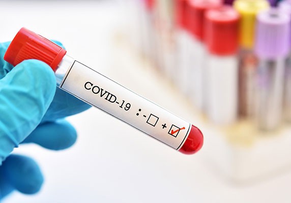 Azərbaycanda daha 127 nəfərdə koronavirus aşkarlandı - 3 nəfər vəfat etdi, 107 pasiyent sağaldı