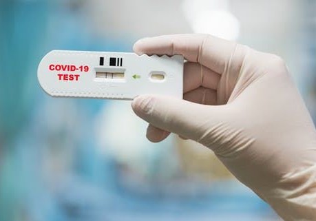 Laboratoriyası olan istənilən özəl klinikaya koronavirusa görə test aparmaq imkanı verilməlidir