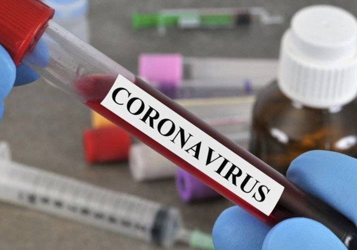 İnfeksionist: "Koronavirusa yoluxanların sayının artması əsgərlərimizə stasionar yardım edilməsini çətinləşdirir"