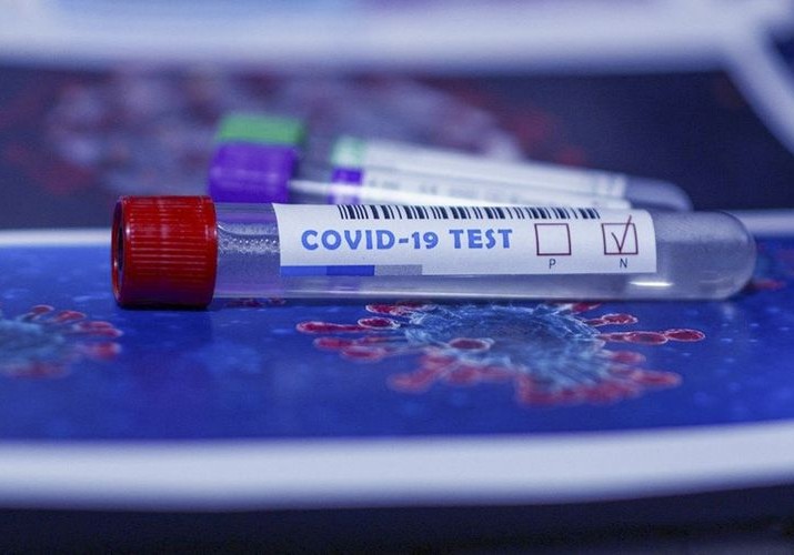 Azərbaycanda indiyədək 3096740 koronavirus testi aparılıb