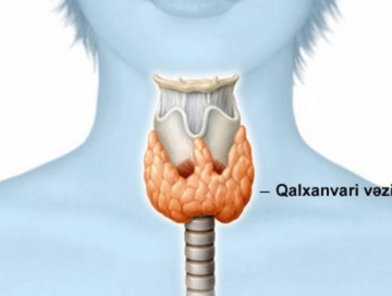 Mayın 25-i Ümumdünya Qalxanabənzər Vəzi Günüdür