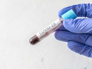 Rusiyada koronavirusun yeni ştamı aşkarlanıb